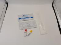 Teste rápido combinado exato da clamídia e da gonorreia para mulheres
