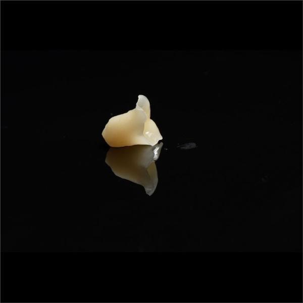 Metal Free Composite Crowns Inlays And Onlays Bridges Implants ODM