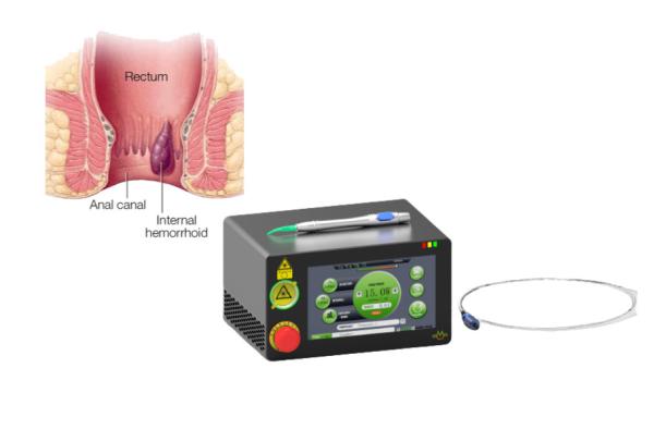 15 Watts Laser Treatment Machine Painless Hemorrhoid Removal 1470 NM Diode Laser