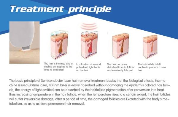 Advanced 808nm diode laser permanent hair removal beauty equipment & machine