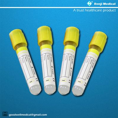 Amostra de sangue transparente do tubo de vácuo do CE com os multi tampões da cor