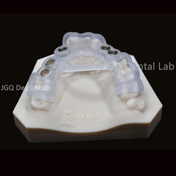 Dental Lab Customized Surgical Guide For Dental Implants 3D Laser Printing