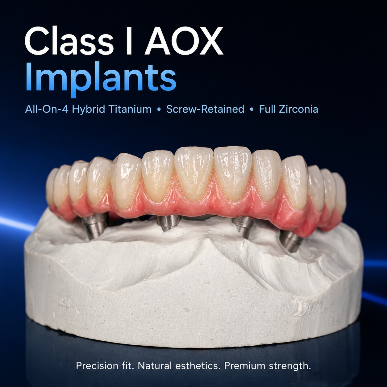 Dental Lab Prosthesis | AOX All‑on‑4 Screw‑Retained Implant Bridge