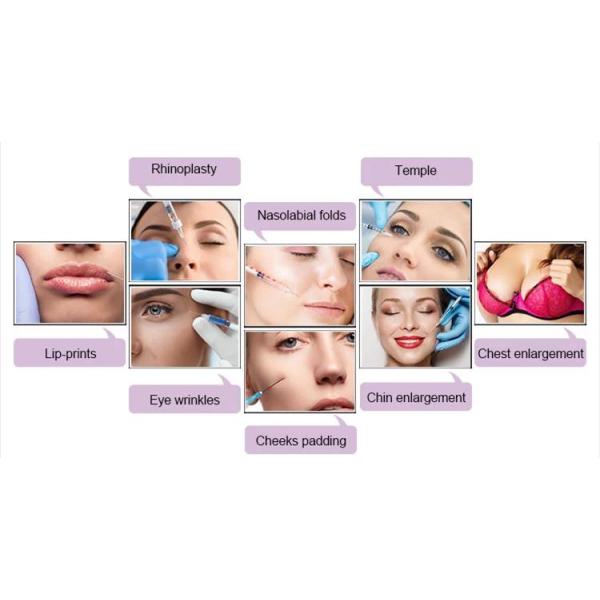 Neofiller Cross Linked HA Dermal Filler For Facial Volume Enhancement