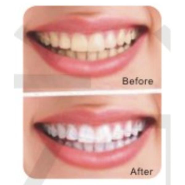 Зубы забеливая для домашней пользы сделанной в наборе Китая самом лучшем качественном забеливая