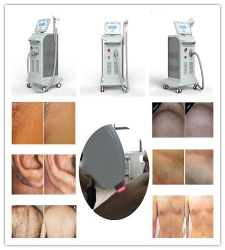 3 years warranty 10.4 inch touch color screen permanent laser diodo 808 nm hair loss laser equipment