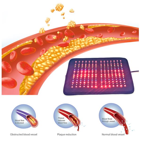 Multicolor пусковая площадка терапией света СИД облегчения боли 210pcs для клиники