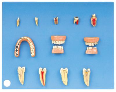 Dental Diseases Model Made of Advanced PVC For Internship And Students Training