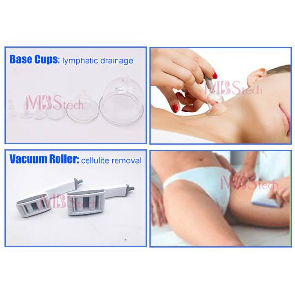 Anti Cellulite Fat Burning vacuum roller rf machine Starvac Machine