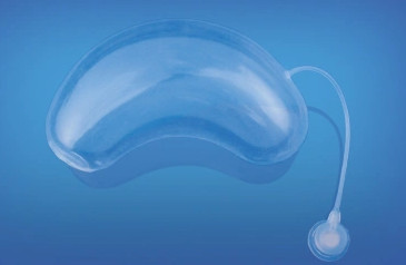 Shape of Kidney Tissue Expander for Implantable Expander