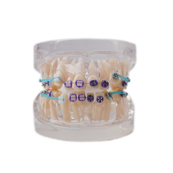 Multi Color Human Teeth Model For Study Dental Orthodontic Teeth Model With Bracket