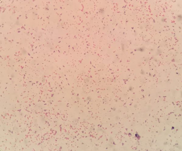 Korotkoff's Stain Efficient Clear Colourful Microbiology Stains For Healthcare Facility