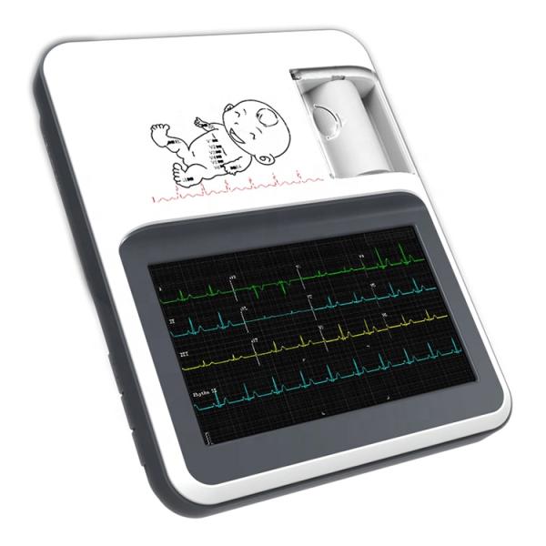 Hot Sale Smart USB Convex Medical Doppler Ultrasound Scanner Ultrasound Probe