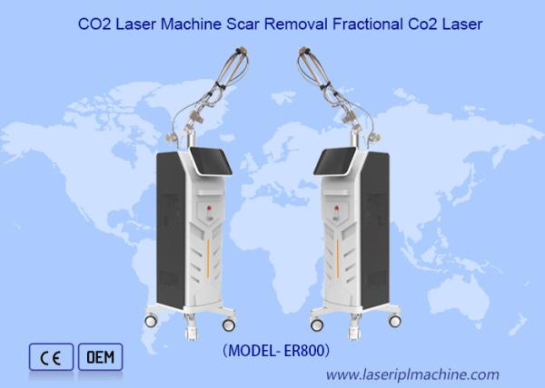 O diodo emissor de luz descasca a máquina 1MHz do emagrecimento do corpo da cavitação do rejuvenescimento para a cara e o corpo