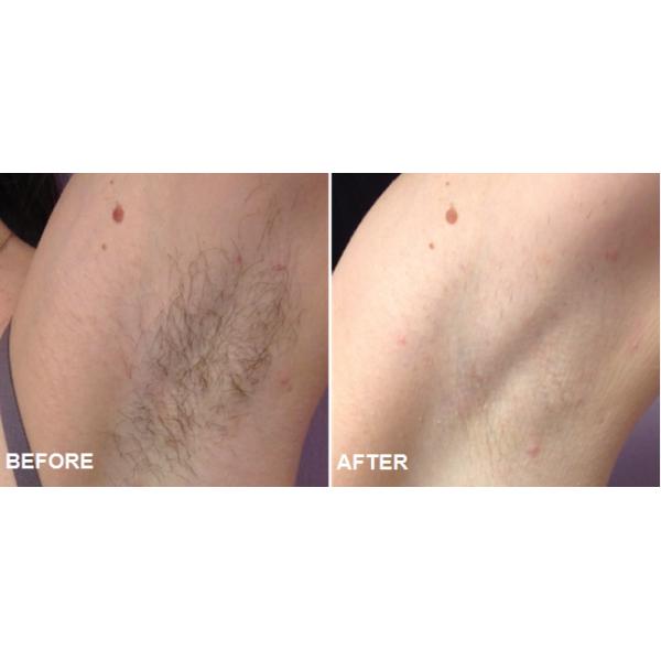 Germany Xenon Lamp Vertical IPL beauty equipment for home with CE Certificate