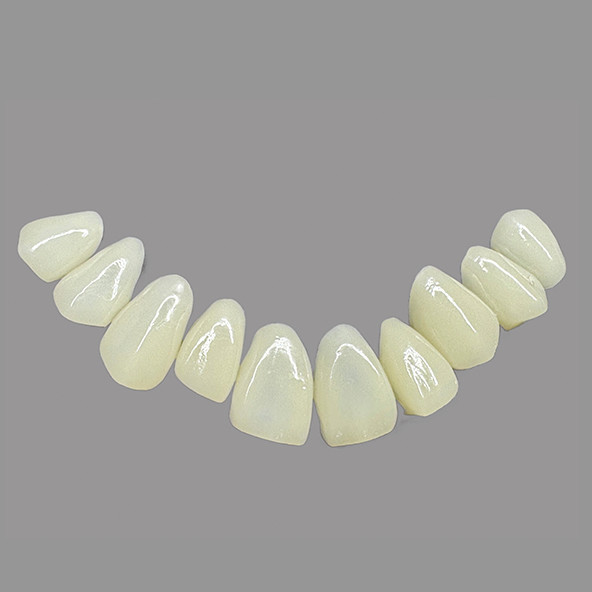 High Translucency IPS E Max Veneers Stains Resistant Biocompatible