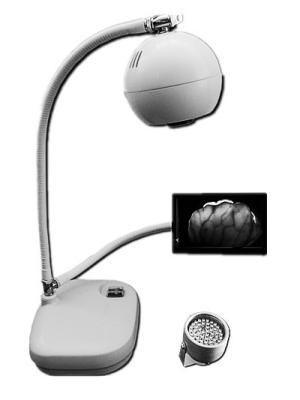 Vascular Images Displaying Veins In Screen Infrared Vein Finder For Nurses And Doctors