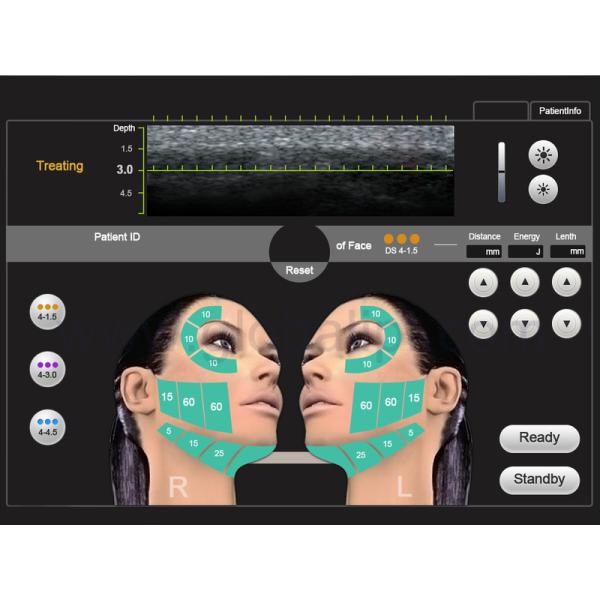 35 * 38 * 58cm HIFU Machine , English Language Non Surgical Face Lift Machine