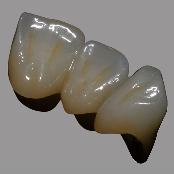 Dental Lab Zirconia Price | Natural Full Contour Zirconia Bridge Single Unit / Multiunit Wear Resistant