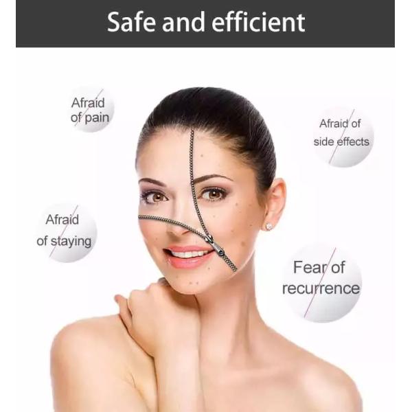 LF-551 Portable mini ozone plasma shower pen acne removal pen for beauty salon use