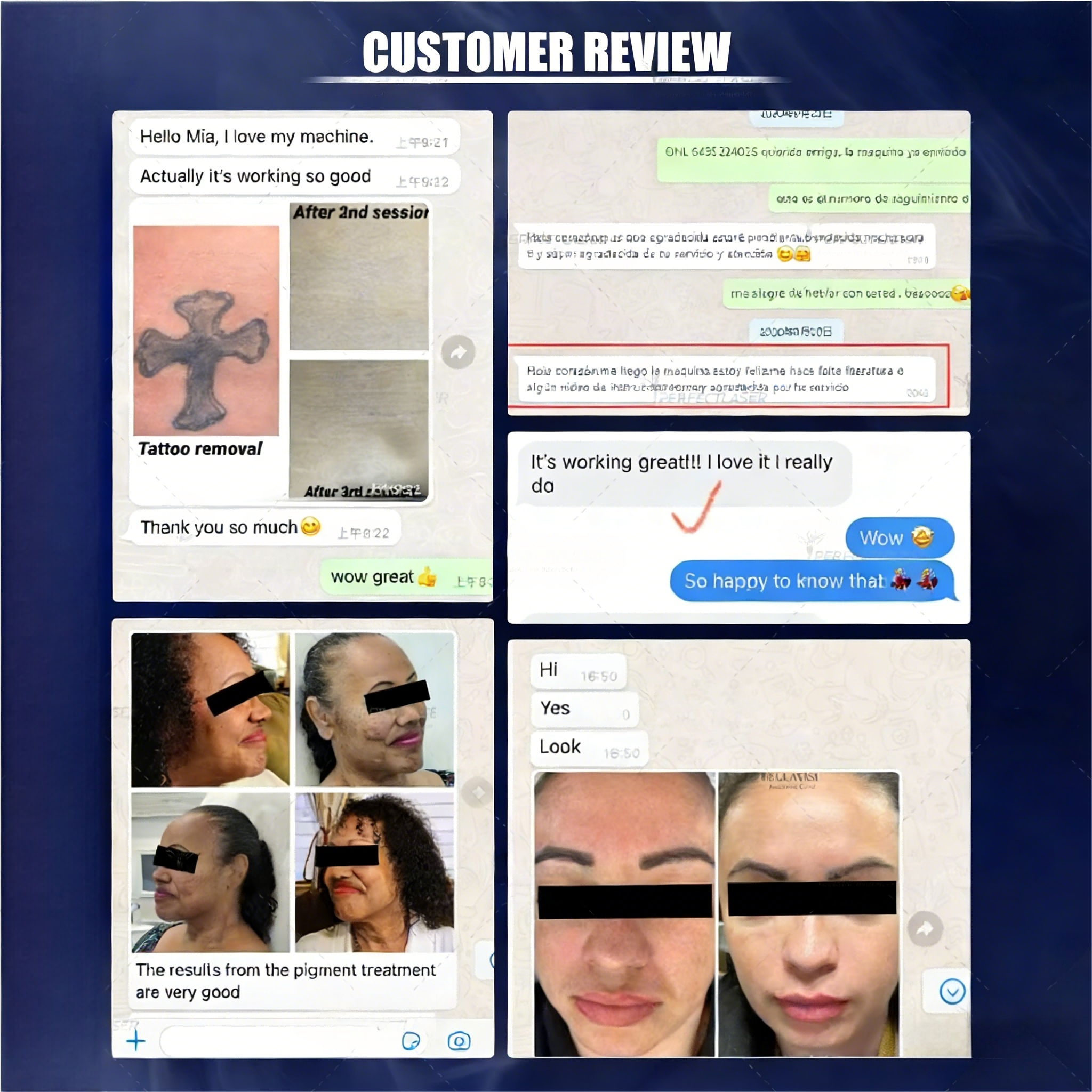 High Power Pico Laser Machine For Tattoo Removal / Melasma / Skin Rejuvenation