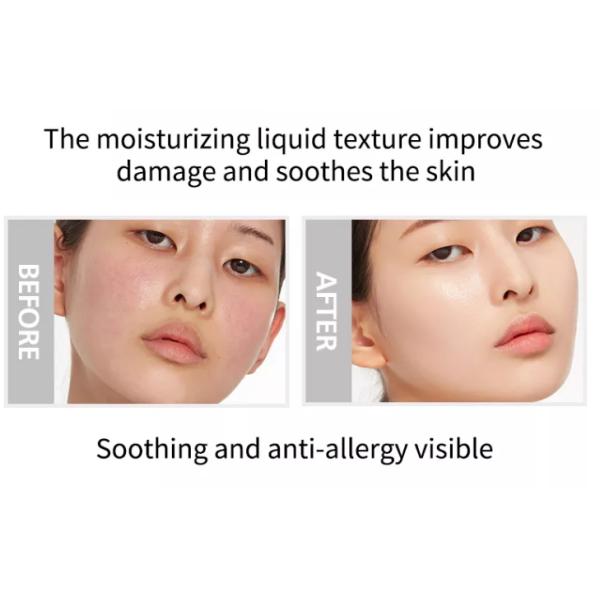 Ясное анти- угорь забеливая лицевую сыворотку Centella ремонтируя 30ml