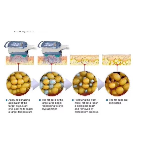 Многофункциональное охлаждая тело Cryolipolysis уменьшая машину для салона красотки