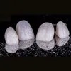 Customized Chinese Dental Lab Zirconia Teeth Precision Overall Dental Restoration