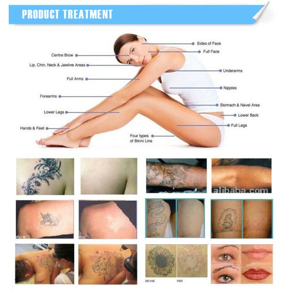 532nm 1064nm 1320nm Q Switched Nd Yag Laser Tattoo Removal Laser Machine for Clinic