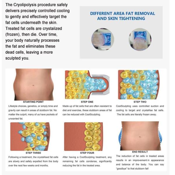 4 Handles Cryolipolysis Fat Freezing Machine With Silica Gel Head CE Certificated