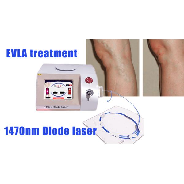 Big power 1470nm diode laser vascular removal  venoclisis laser evlt lipolysis