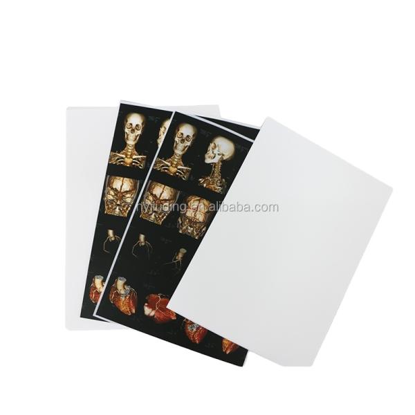 125 Microns White Inkjet X Ray Film A4 B5 16K Inkjet Printing Film