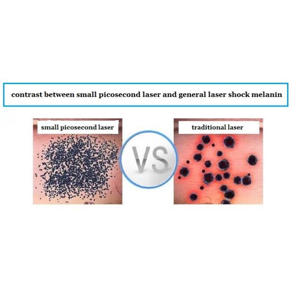 Factory price Nice quality 1064nm &532nm pigmentation removal picosure tattoo removal machine