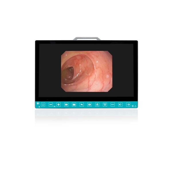 TUYOU 13.3-Inch FHD Flexible Endoscope Camera System Multi-Color OEM Custom All-in-One Portable Uro-Gyn TikTok Hit