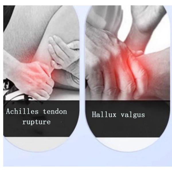 Медицинское устройство реабилитации связок коленного сустава лодыжки, ноги, плечевой ремень, брекеты, телят, послеоперационная коррекция