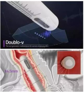 Линии 8 затягивать GOMECY 12 кожи машины подниматься стороны патронов 4D Hifu