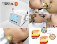 Machine partielle portative de rf Microneedle pour la réduction de ride de cou