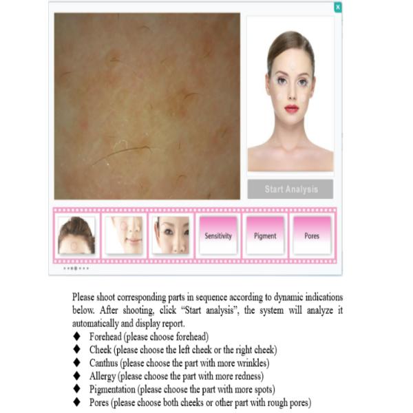 Многофункциональный наблюдаемый анализатор объема кожи