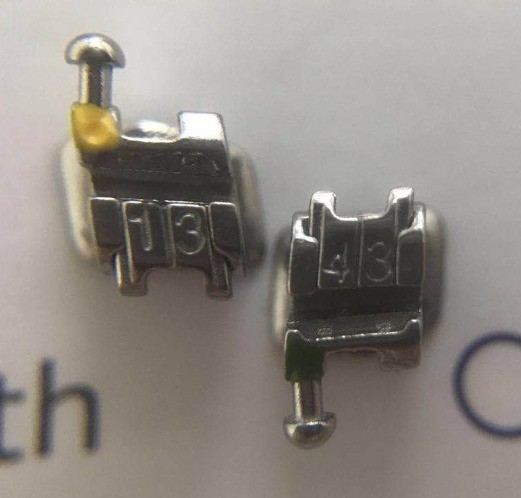 Manual Power Source 's Self Ligating Sandblasted MBT Brackets for Orthodontic Solution