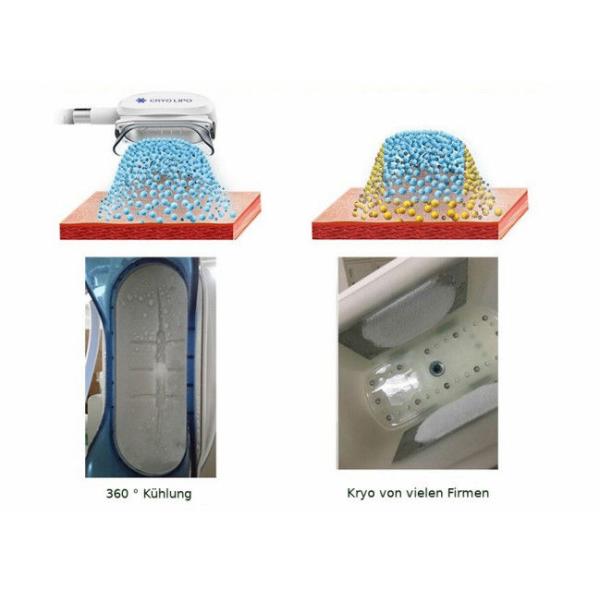 500W Portable 360 Cryolipolysis Cryo Fat reduction Machine