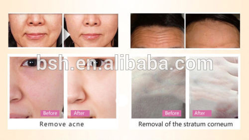 Portable Rechargeable 2in1 Ultrasonic Facial Skin Scrubber Anti-aging Lift