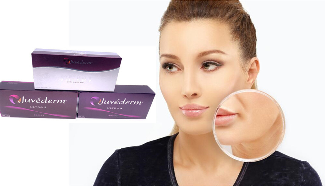 Juvederm ультра 4 впрыски дермальных заполнителя Hyaluronic кисловочных для губ