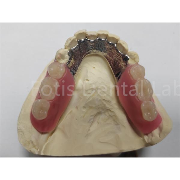 OEM Flexible Removable Partial Denture Easy To Clean / Maintain