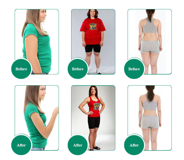 Машина 0-90Kpa Cryolipolysis 7 ручек не хирургическая