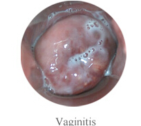 Видеокамера камеры Cervix для влагалищной Handheld собственной личности Colposcope цифров миниой - осмотра с увеличением 1,5 времен