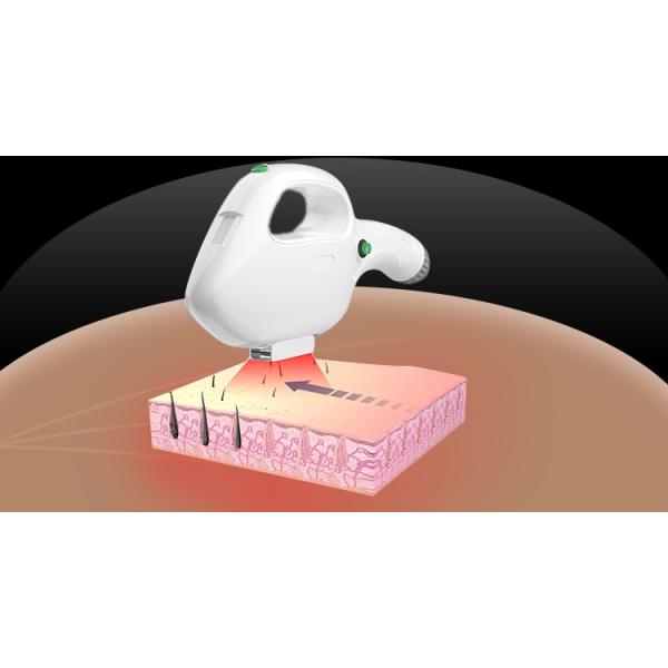 New Style OPT / IPL RF Beauty Equipment SHR IPL Hair Removal 10MHz RF Frequency