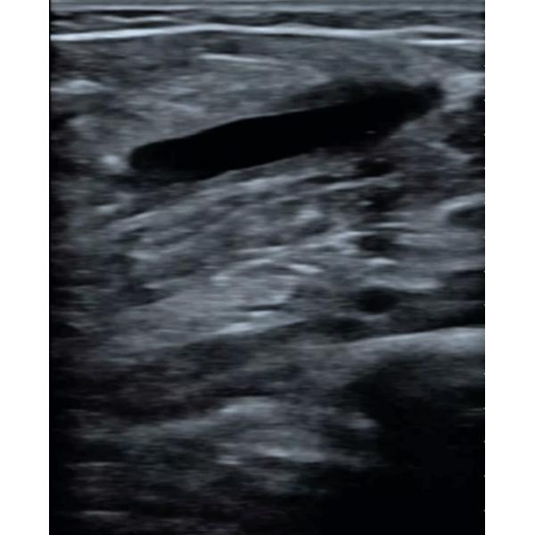 Veterinary Ultrasound System Bovine Ultrasound Machine 4.0MHz 6.0MHz 8.0MHz