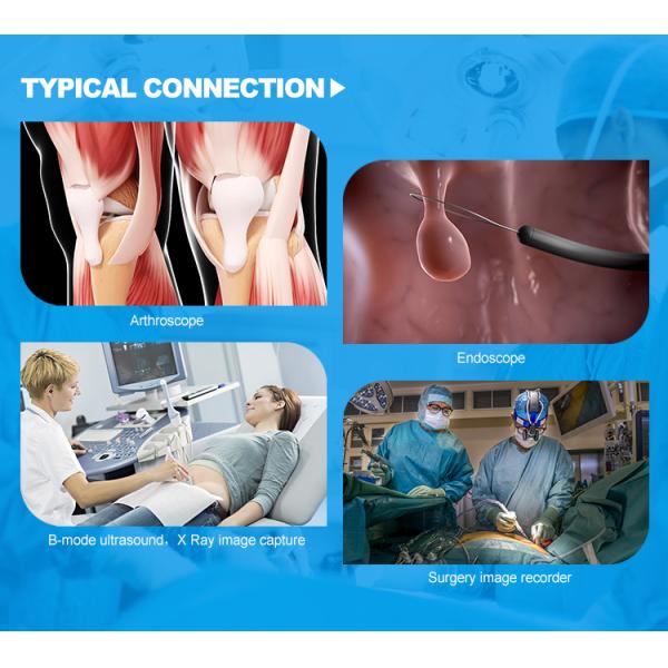 Больничный медицинский видеорегистратор для эндоскопа артроскопии УЗИ