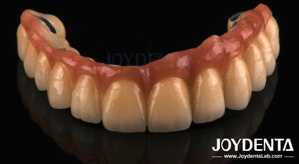 Casting And Milling PFM Tooth Crown , Dental Restorations Porcelain Fused Metal Crown
