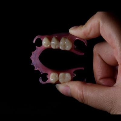 Lightweight Flexible Valplast Partial Denture For Single Tooth